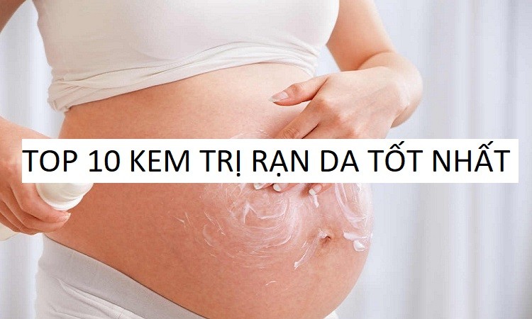 Top 10 loại kem trị rạn được tin dùng