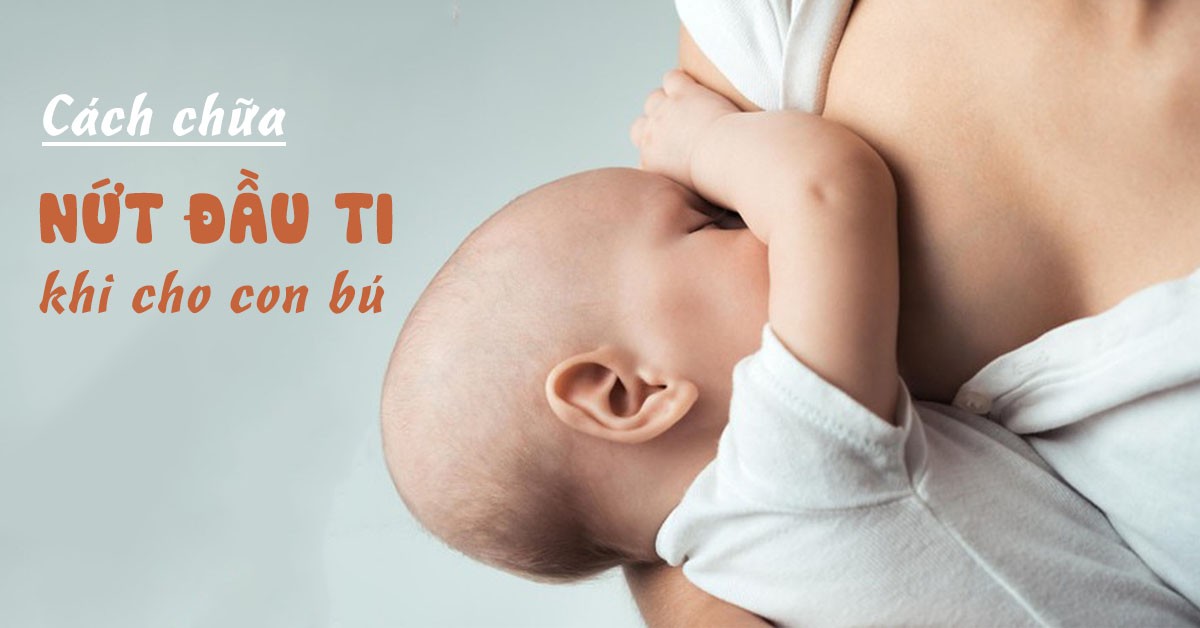 Những điều cần biết về nứt cổ gà mẹ bỉm sữa nên biết