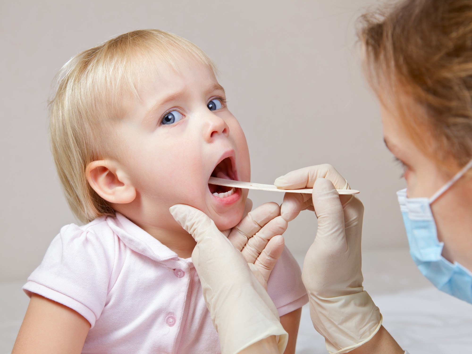 Nhổ răng sữa cho trẻ như thế nào là tốt?