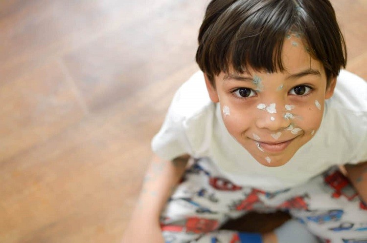 Bệnh zona ở trẻ sơ sinh triệu chứng và cách chữa trị