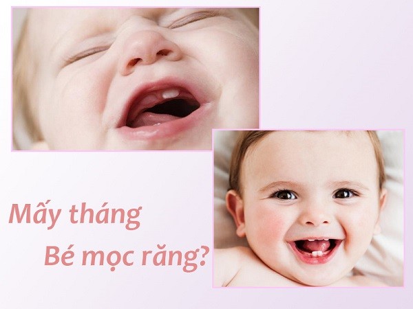 Trẻ sơ sinh mấy tháng mọc răng? Trình tự mọc răng của trẻ