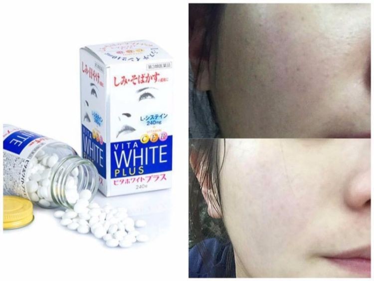 Viên uống Vita White Plus