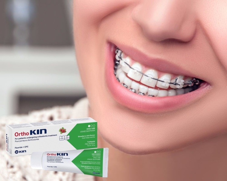 Hỗ trợ ngăn ngừa sâu răng, đánh bay các mảng bám cho người niềng răng