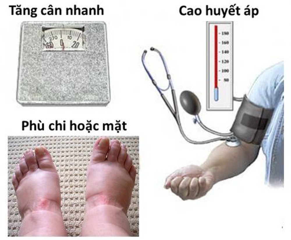 tiền sản giật tháng cuối, tiền sản giật khi mang thai, dấu hiệu tiền sản giật ở bà bầu, tiền sản giật ở bà bầu, nguy cơ tiền sản giật ở bà bầu, tiền sản giật thai kỳ, bệnh tiền sản giật ở phụ nữ mang thai, triệu chứng tiền sản giật ở bà bầu, tiền sản giật ở phụ nữ mang thai, bệnh tiền sản giật ở bà bầu, hiện tượng tiền sản giật ở bà bầu, tiền sản giật ở thai phụ, tiền sản giật trong thai kỳ, thai phụ bị tiền sản giật, mẹ bầu bị tiền sản giật, bà bầu bị tiền sản giật, triệu chứng tiền sản giật ở thai phụ, tiền sản giật ở bà bầu la gi, chứng tiền sản giật ở bà bầu, biểu hiện của tiền sản giật ở bà bầu, tiền sản giật ở bà bầu là gì