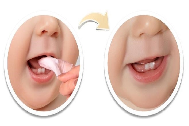 bé mấy tháng mọc răng, mấy tháng mọc răng, trẻ mấy tháng thì mọc răng, trẻ em mấy tháng mọc răng, em bé mấy tháng mọc răng, trẻ mọc răng sớm nhất là mấy tháng, trẻ em mấy tháng thì mọc răng, trẻ mấy tháng tuổi thì mọc răng, bé mấy tháng mới mọc răng, trẻ mấy tháng mọc răng là bình thường