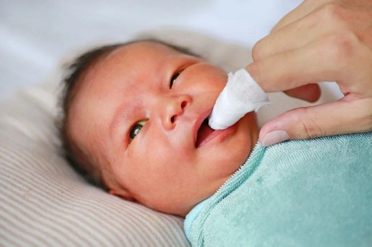 đồ rơ lưỡi cho trẻ sơ sinh, cách rơ lưỡi cho bé sạch, hướng dẫn rơ lưỡi cho trẻ sơ sinh, mẹo rơ lưỡi cho trẻ sơ sinh, rơ lưỡi cho trẻ sơ sinh bằng nước gì, cách rơ sạch lưỡi cho trẻ sơ sinh, hướng dẫn cách rơ lưỡi cho trẻ sơ sinh, cách rơ lưỡi sạch cho trẻ sơ sinh, rơ lưỡi cho trẻ sơ sinh như thế nào, cách làm sạch rơ lưỡi cho trẻ sơ sinh, cách lấy rơ lưỡi cho trẻ sơ sinh, cách rơ lưỡi cho trẻ sơ sinh bằng denicol, cách chữa rơ lưỡi cho trẻ sơ sinh