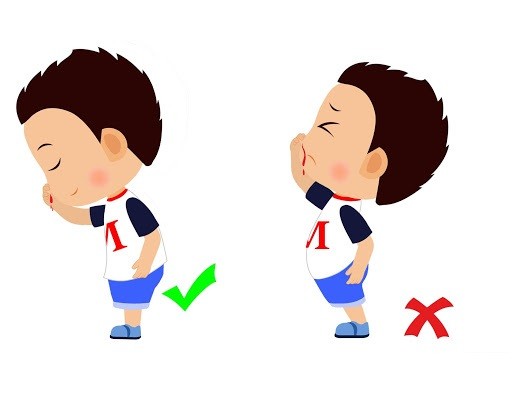 Chảy máu cam ở trẻ là bệnh gì