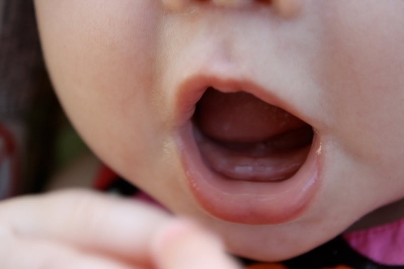 bé chậm mọc răng, bé chậm mọc răng nên ăn gì, vì sao trẻ chậm mọc răng, nguyên nhân trẻ chậm mọc răng, trẻ chậm mọc răng nên bổ sung gì, trẻ chậm mọc răng có sao không, bé chậm mọc răng phải làm sao, bé chậm mọc răng có sao không, tại sao trẻ chậm mọc răng, vì sao bé chậm mọc răng, trẻ chậm mọc răng phải làm sao